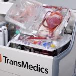 Bahnbrechende Technologie ermöglicht Transplantation "toter" Herzen