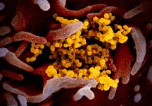 Adventisten: Kirchenleitungen und Hilfsorganisationen gemeinsam gegen Coronavirus