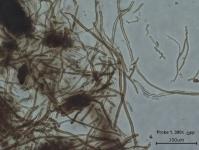 Fascinating medicinal mushrooms