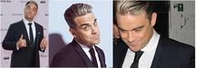 Superstar Robbie Williams steht zu seiner Eigenhaarverpflanzung
