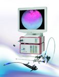 Blasenkarzinome: Qualität der Lichtquelle bei photodynamischer Diagnostik entscheidend