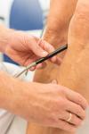 Thrombosen – erste Anzeichen ernst nehmen