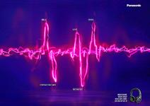 Brillanter Sound braucht Höhen und Tiefen