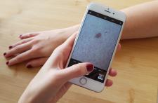 Fachärztliche Diagnostik ohne Ansteckungsgefahr: "Online Hautarzt vor Ort"