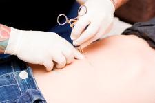 Medizinischer Expertenrat im Online-Chat: Tattoo und Piercing - Welche Risiken birgt der Körperschmuck?