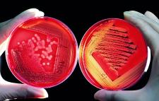 Internationaler Antibiotika-Tag: Effektiver Einsatz, Eindämmung von Resistenzen