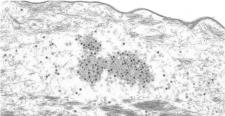 Falsche Fährte: Wie Papillomviren das Immunsystem austricksen