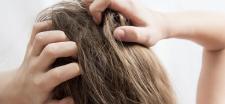 Bringing Itchy Scalp back into Balance