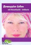 Kostenfreies Webinar zum Welt-Urtikaria Tag