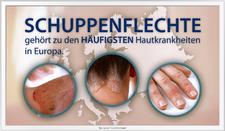 29. Oktober: Welt Psoriasis-Tag