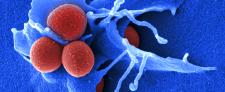 Wie multiresistente Keime entschärft werden können