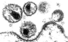 Tabuzonen für das Aidsvirus