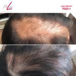 FitLine macht die Haare schön