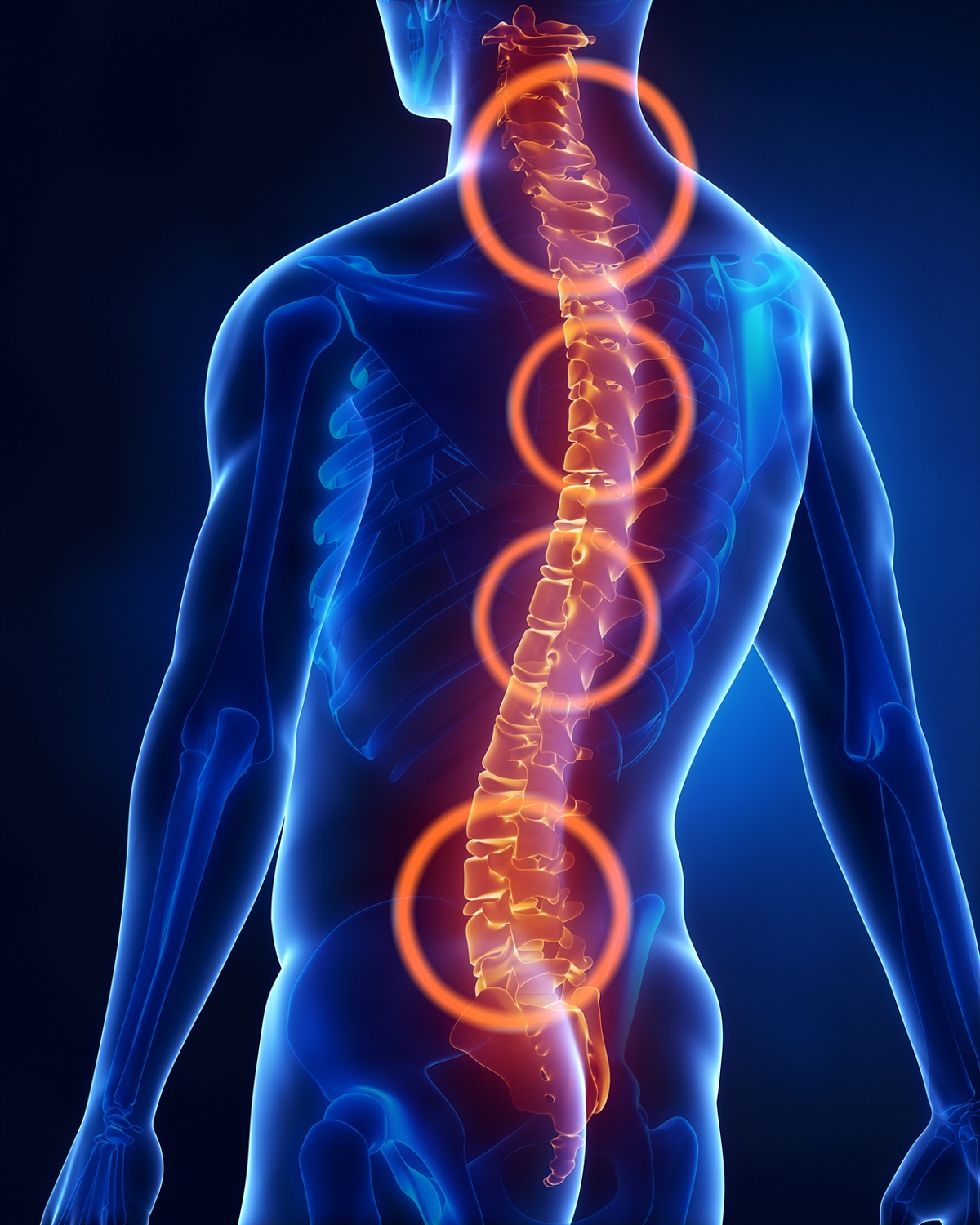 Olgun dikkatlice hostes  Millimeter-Operationen“ gegen chronische Rückenschmerzen, NewsWork AG,  Pressemitteilung - lifePR