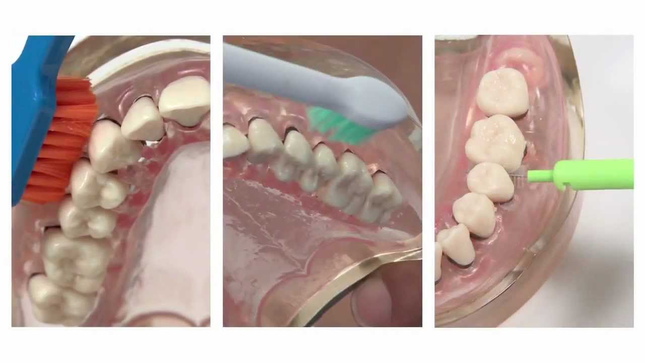 Gesunde Zähne mit System