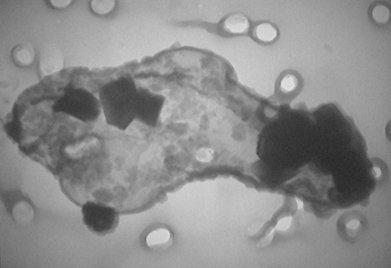 Nanobubble Uni Gießen.jpg