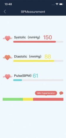 NX-4607_13_newgen_medicals_Medizinische_Blutdruck-Armbanduhr_BPW-100_App.jpg