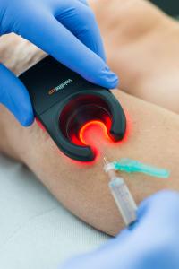 Behandlung mit Veinlite