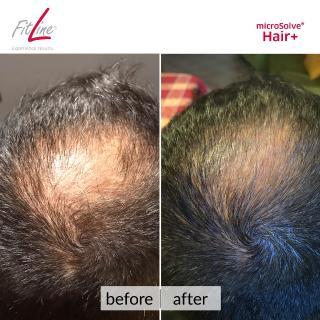 FitLine macht die Haare schön