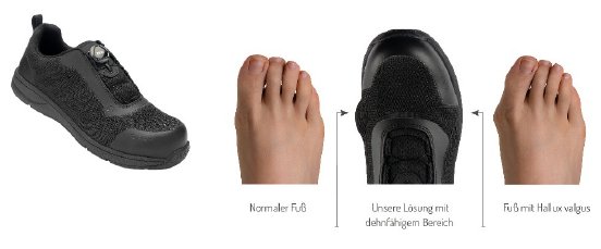 Sid%20u%20Schaubild%20Hallux.jpg