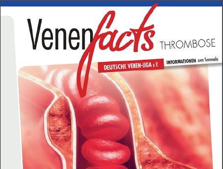 venenfacts thnrombose.png