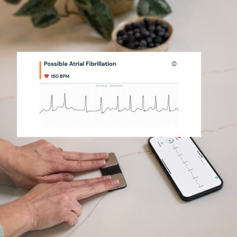 Alivecor-2-3.jpg