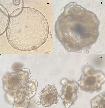 Mikroskopische Aufnahmen patientenspezifischer Organoidkulturen_UMMD.jpg