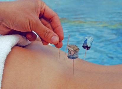 Wie die Heilmethoden der Traditionellen chinesischen Medizin wirken, kann man jetzt im Urlaub in Viechtach im Bayerischen Wald ausprobieren. Neu ist die Kombination der TCM-Therapien mit den legendären Heilmethoden des berühmten Wasserpfarrers Sebastian Kneipp. Foto: obx-news