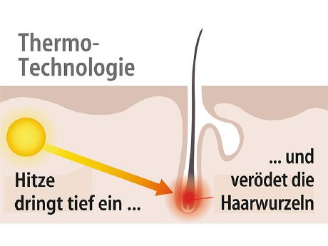 NC-3903_6_Sichler_Haarentferner_mit_Thermo-Technologie_3_Hitze-Stufen_inkl_Zubehoer.jpg