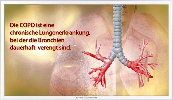 TV-Wartezimmer_COPD_300dpi.jpg