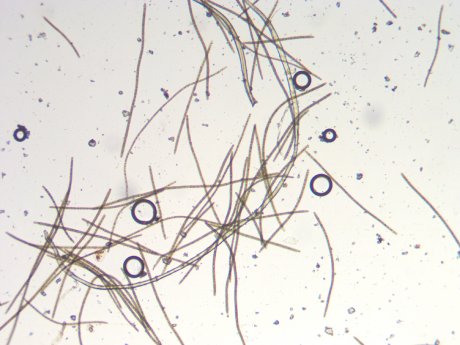 Algen unterm Mikroskop_©Averberg.jpg
