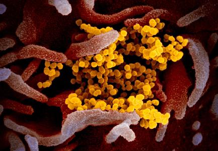 Diese rasterelektronenmikroskopische Aufnahme zeigt SARS-CoV-2 (gelb) - auch bekannt als 2019-nCoV, das Virus, das COVID-19 verursacht - isoliert von einem Patienten in den USA es tritt an der Oberfläche von im Labor kultivierten Zellen (rosa) aus