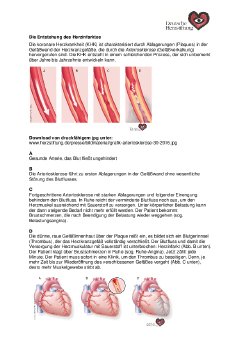 Weltherztag_BildmateriaL_Herzinfarkt_KHK_Reha_2017.pdf