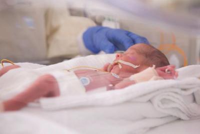 Säugling auf der Kinderintensivstation / Foto: Clementine Kinderhospital - Dr. Christ’sche Stiftung