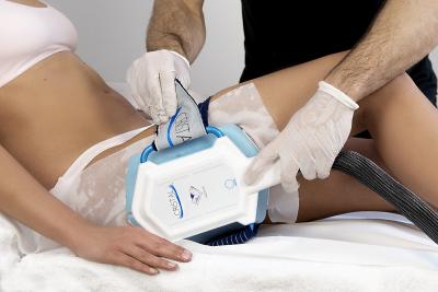 Fettzellenbehandlung mit ICE AESTHETIC®