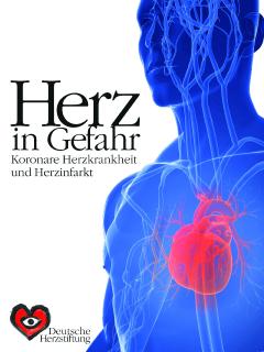 Herzkrank in die Sauna: Was geht und was ist tabu? (Bildnachweis: Fotolia.com/Sebastian Kaulitzki)