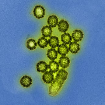 H1N1_Influenza_Virus_Particles__8411599236__credit_NIAID_cc-by-20.jpg