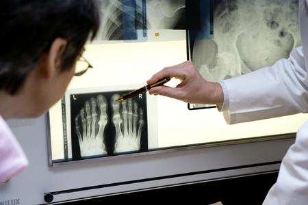Arzt erklärt einer Patientin mit Rheuma ihre Röntgenbilder