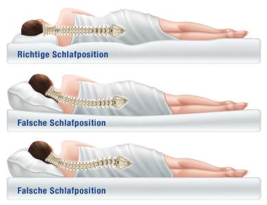 Rückenschmerzen sind längst zur Volkskrankheit Nr. 1 geworden. Oft werden die Ursachen dafür in falscher Belastung, zu langem Sitzen oder einer Vielzahl anderer Faktoren im Tages- und Arbeitsablauf vermutet. Doch auch wenn die Wachphasen wichtige Anhaltspunkte liefern, kommt der Schlaf oft zu kurz bei der Ursachensuche. / Bild: Adobe Stock/ AGR