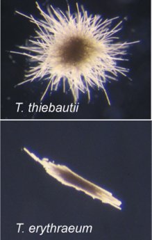 Trichocolonies_From Wood's Hole Oceanographic Institution..jpg