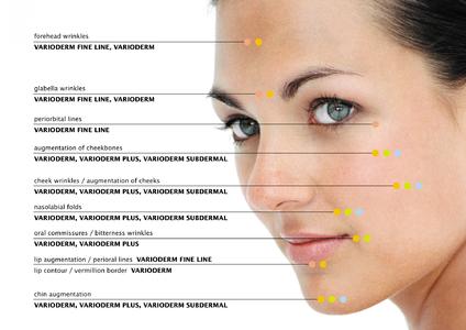 Derma-Filler VARIODERM®