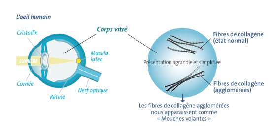Graphique 2  L’œil humain et le corps vitré.png