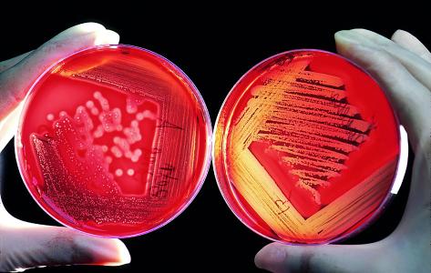 Internationaler Antibiotika-Tag: Effektiver Einsatz, Eindämmung von Resistenzen