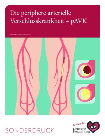 DHS_Cover_pAVK-Broschüre_2025.jpg