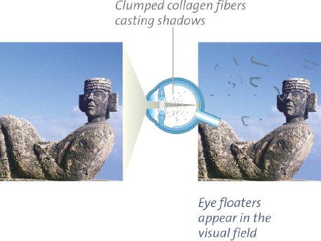 clumped-collagen-fibres-pic_rgb.jpg