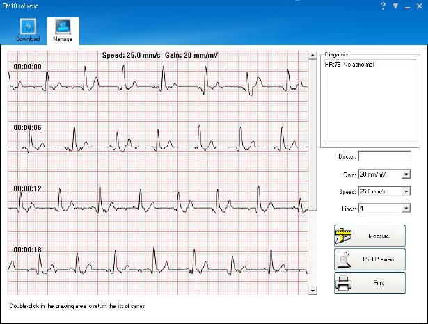 NX-4590_07_newgen_medicals_Mobiles_medizinisches_EKG-Messgeraet_mit_Software_Screen.jpg