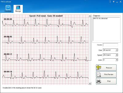 NX 4590 07 newgen medicals Mobiles medizinisches EKG Messgeraet mit Software Screen
