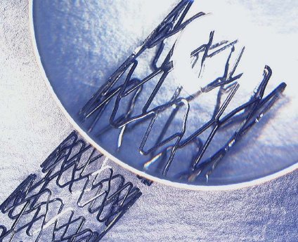 Stents-5.jpg