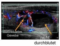 durchblutet