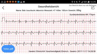 newgen medicals Fitness-Armband FBT-105 mit Blutdruck-Anzeige, Herzfrequenz & Bluetooth, IP67